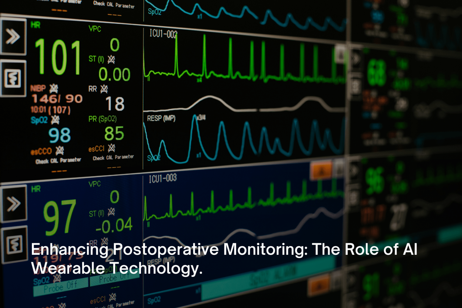 Fitmust Enhancing Postoperative Monitoring: The Role of AI Wearable Technology ...